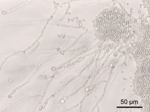 candida albicans under a microscope